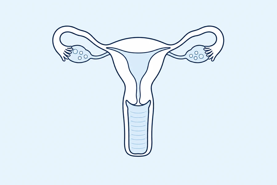 Gynecology