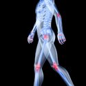 Pain Management